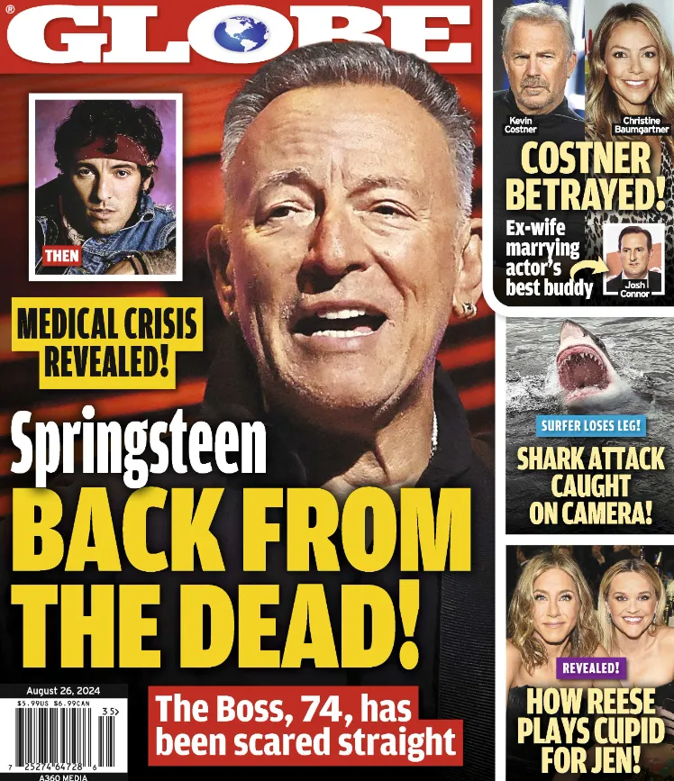 Globe - 08.26.24 Springsteen Back from the Dead